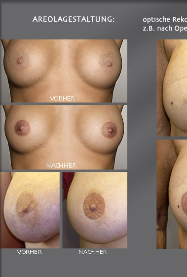 permanentmakeup brust areola pigmentierung